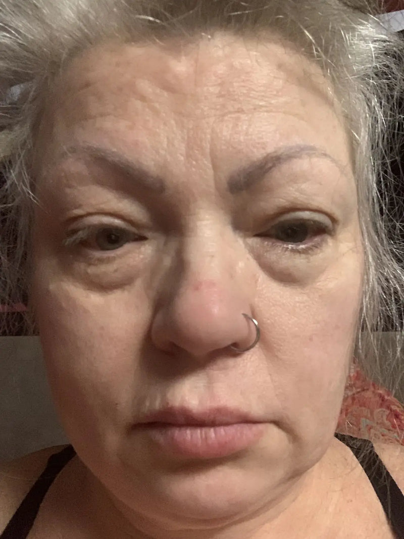 Linda, 59 — before