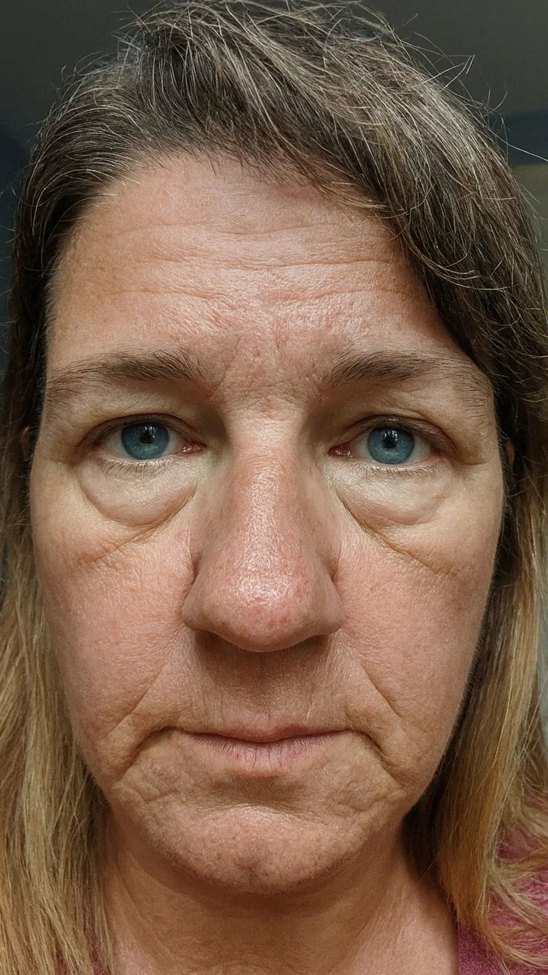 Angela, 58 — before