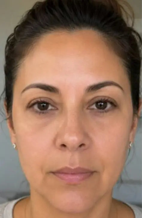 Anna, 45 — after